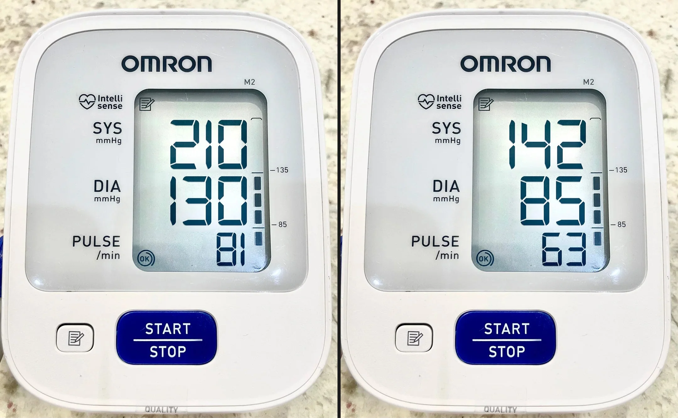 The Silent Killer in Your Arteries: How I Lowered My Deadly High Blood Pressure Without Dangerous Medications