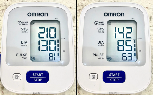 The Silent Killer in Your Arteries: How I Lowered My Deadly High Blood Pressure Without Dangerous Medications
